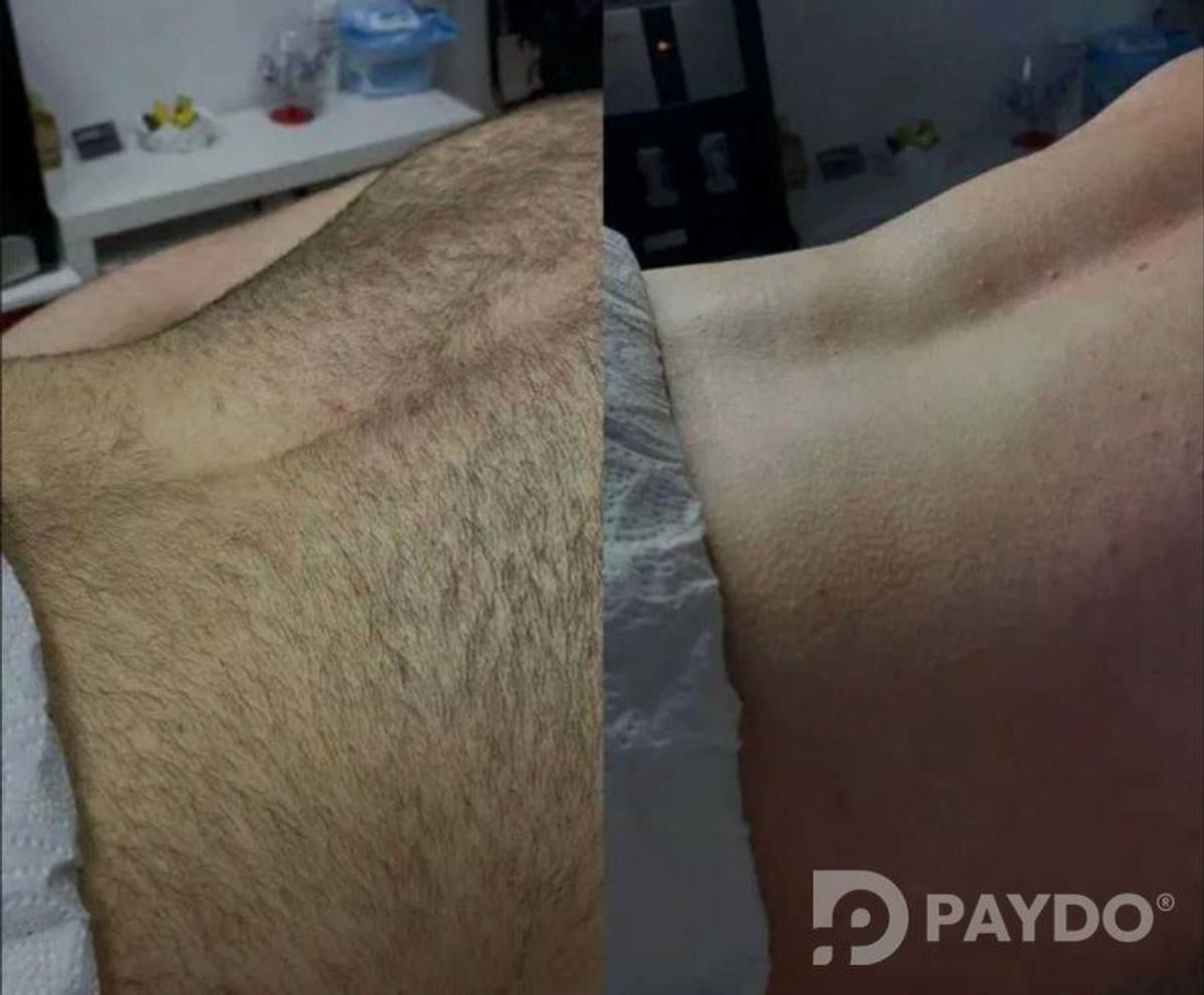 шугаринг у себя дома
